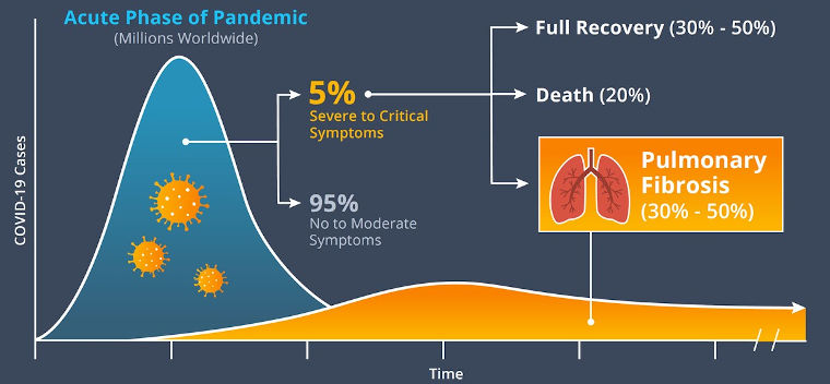 Acute phase of pandemic
