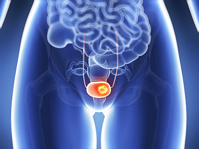 Urologie