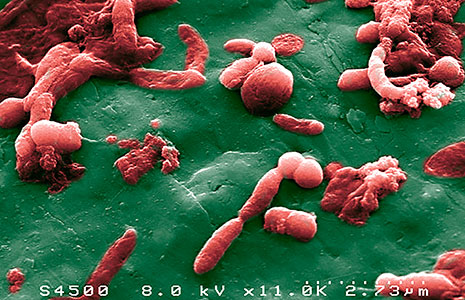 immunothérapie - microbiote