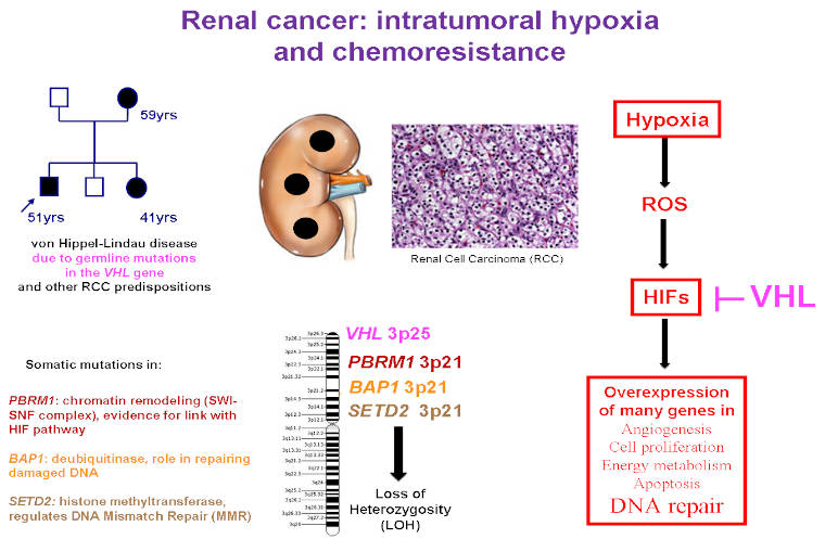 Cancer du rein (RCC) : gènes mutés, hypoxie intra-tumorale et chimiorésistance.