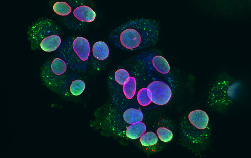 Grâce aux inhibiteurs de PARP, les cellules cancéreuses rejettent leur ADN en dehors de la membrane, favorisant ainsi une réponse immunitaire.