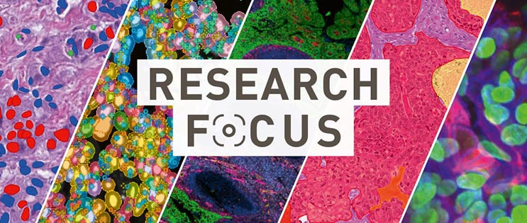 bannière title research focus