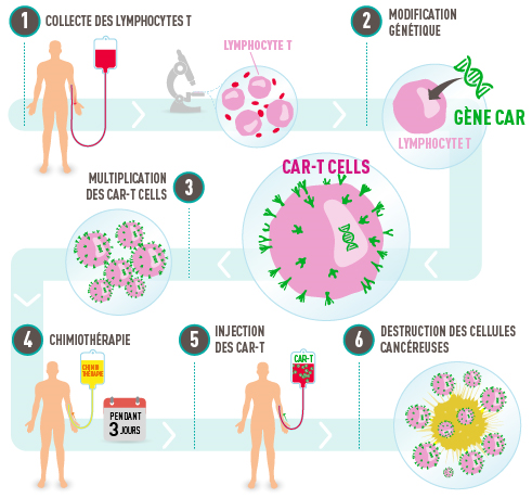 cellules CAR-T 