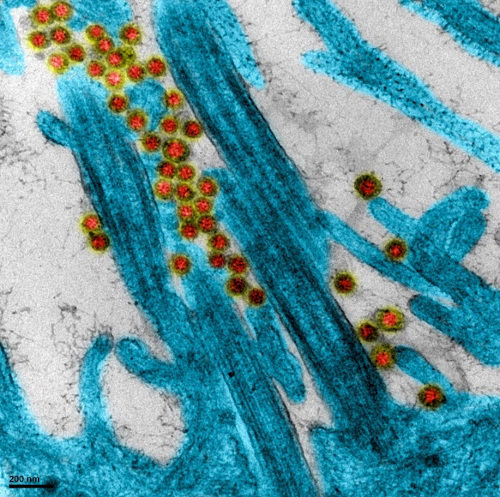 INSERM : Une des toutes premières images du virus SARS-CoV-2