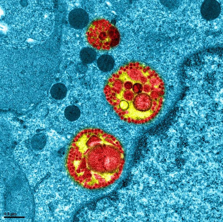 Cellule respiratoire infectée 