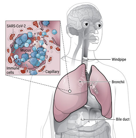 physiologie de SARS-CoV-2 