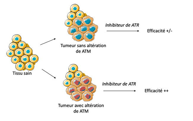 Cibler ATR dans les tumeurs 