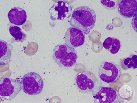 monocytes 
