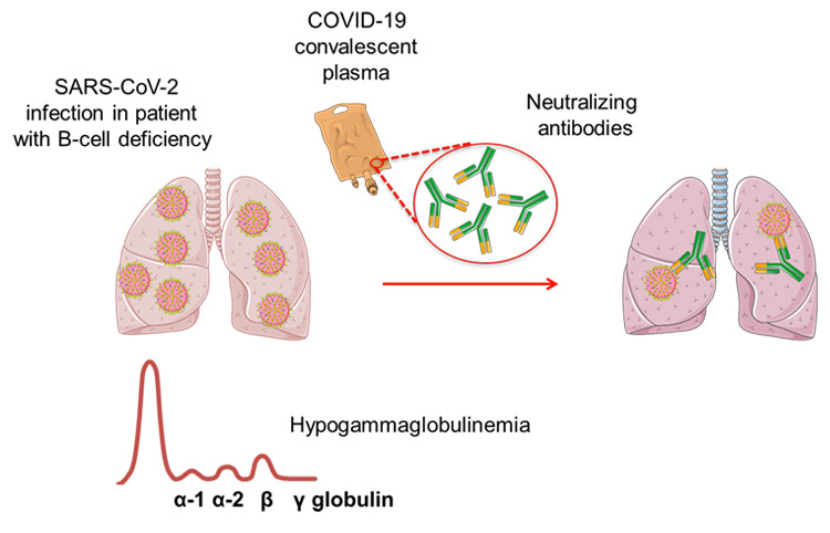 plasma convalescent 