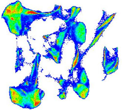 Caratérisation cellules souches leucémiques