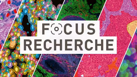 Vignette focus recherche