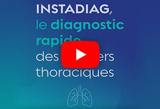InstaDiag Poumon, le parcours de diagnostic rapide des cancers thoraciques