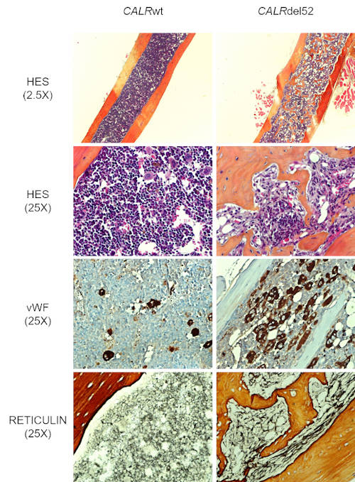 Bone marrow analysis of CALRdel52 mice