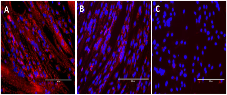 Inhibition de la différenciation des cellules musculaires par co-culture indirecte (système Transwell) avec des cellules malignes de carcinomes ORL. 
