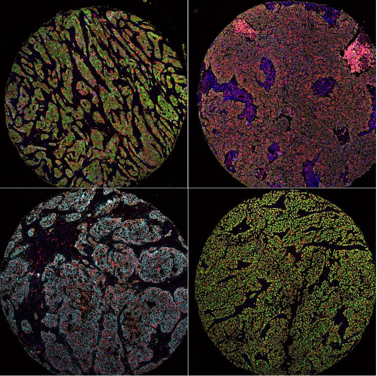 Immunohistochemistry multiplex