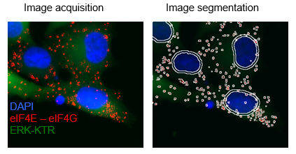 Adaptative resistance to anticancer-therapies