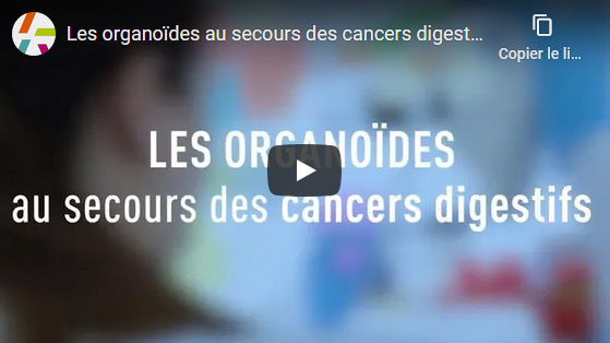 Les organoïdes au secours des cancers digestifs