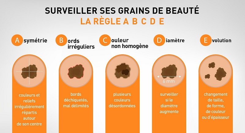 Règle ABCDE pour surveiller ses grains de beauté